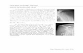 Labral Repair and Shoulder Dislocation Anatomy …...Dislocation of the shoulder after labral repair is uncommon, occurring in ~7% of patients. Up to 90-100% of patients are able to