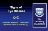 Signs of Eye Disease - Auckland€¦ · Visual field defects . Tunnel vision . Visual field defects . Eye movements . Eye movements . Pupil reactions • Responses to light •Direct