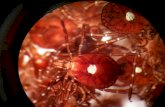 Minimizing tick bite exposure - WordPress.com · Arkansas Ticks Hard Ticks (Ixodidae) •Lone star tick - Amblyomma americanum •Gulf Coast tick - Amblyomma maculatum •American