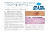 Case Report: Cutaneous Metastasis of Adenocarcinoma · Immunohistochemical (IHC) staining plays a key role in con-junction with the patient’s history and clinical presentation.