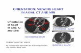 ORIENTATION: VIEWING HEART IN AXIAL CT AND MRI · 20 MINUTE ANATOMY VIDEOS No sinner is ever saved after the first twenty minutes ... Trachea Subclavian V. Left Int. Jugular V. AORTA