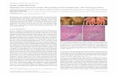 Idiopathic Pure Sudomotor Failure Responding to Oral ...€¦ · dose (120 mg/day), which was gradually increased up to 3-fold the normal dose. A few days after initiation of the