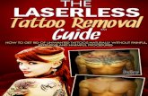 The Laserless Tattoo Removal Guide · the art tattoo removal techniques won’t work for everyone. Before we discuss tattoo removal techniques, let us quickly remind ourselves what