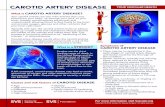 CAROTID ARTERY DISEASE YOUR VASCULAR HEALTH · 2018-12-03 · Carotid artery disease results when the carotid arteries become narrow or obstructed and provide a risk of the plaque