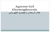 Agarose Gel Electrophoresis‡لام...•Gel electrophoresis is a widely used technique for the analysis of nucleic acids and proteins. Agarose gel electrophoresis is routinely used