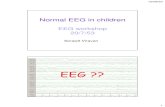 Normal EEG in children - thaiepilepsysociety.com EEG in children.pdfFp1 and Fp2 pick up negativity upward deflection at Fp1-F7, Fp2-F8. 02/08/53 27 Eye closed Eye opening +-Horizontal
