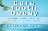 A Special Note for Book Preview Readers - Your Return · On-Teeth Causes Cavities Tooth Care 159 Healing Tooth Pain 159 Dental Sealants 159 Teeth Cleaning at the Dentist 160 Teeth