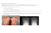 Forefoot reconstruction · 2018. 2. 22. · Forefoot reconstruction Inflammatory arthritis (such Rheumatoid arthritis and Lupus) lead to deformities that are more severe and disabling