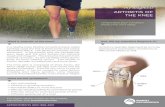 7886 Arthritis of the Knee 12-16 digital...The knee joint is composed of three bones; the femur (thigh bone), the tibia (shin bone) and the patella (kneecap). Arthritis can occur in