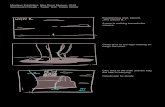 Moebius Exhibition, Max Ernst Mueum, 2018 Storyboard Rough ... Storyboard Rough - Trailer Test: Tristan