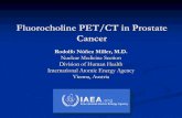 Fluorocholine PET/CT in Prostate Cancer · 18 Fluorocholine PET/CT Indications Assessment of extent of disease -regional and/or distant-, or with doughfull findings on conventional
