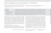 Neuroimaging in the Evaluation of Epilepsy...Neuroimaging in the Evaluation of Epilepsy Naymee J. Velez-Ruiz, MD1 Joshua P. Klein, MD, PhD2 1Division of Epilepsy, Department of Neurology,