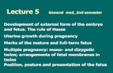 Lecture5 GenMed 2nd semester - Masaryk University · 2010. 10. 3. · Monozygotic twins around the end of the second week (between day 13- 15) if the duplicated primitive streak and