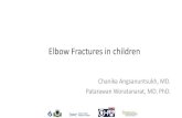 Fractures in children - Mahidol University...Supracondylar is the thinnest part of distal humerus, just superior to the condyles.\爀屲Supracondylar fracture is a fracture of\ഠthe