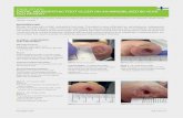 CASE STUDY: DISTAL NEUROPATHIC FOOT ULCER ON ......CASE STUDY: DISTAL NEUROPATHIC FOOT ULCER ON AN IMMOBILISED 86 YEAR OLD PATIENT woulgan.com Week 12 - 24th November 2016 (Figure