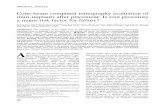 Cone-beam computed tomography evaluation of mini-implants after placement: Is root ... · 2017. 12. 2. · proximity showed mesiobuccal contact with the maxillary ﬁrst molar root.
