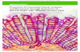 Promotion of Colorectal Cancer Invasion and Metastasis ...when colorectal cancer cells with activated NOTCH signaling are placed on an endothelial cell (EC) layer in culture. Thus,
