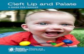 Cleft Lip and Palate 2018. 12. 4.¢  Cleft Lip and Palate: A Guide for Families Cleft Lip and Palate: