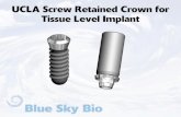 UCLA Screw Retained Crown for Tissue Level Implant · The presentation that follows lists only one combination of parts. Obviously the clinical situation may call for substitution