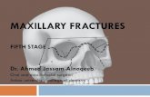 Maxillary fractures · Stages of surgery in multiple facial injuries 1. Tracheostomy 2. Dentoalveolar # a. Extraction of unrepairable teeth b. Reduction & fixation 3. Reduction of