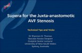 Supera for the Juxta-anastomotic AVF Stenosis...Supera for the Juxta-anastomotic AVF Stenosis Technical Tips and Tricks Dr Shannon D. Thomas Vascular Access Surgeon Conjoint Senior