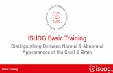 ISUOG Basic Training...Basic Training Plane Description Structures to be evaluated2,3,4 Measurement1,2 & criteria for referral Abnormalities that can be excluded from the normal appearances