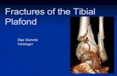 Plafond Fractures of the Tibial · Objectives nDefine pilon fractures nClassify pilon fractures nDiscuss treatment protocols nStaged management nDefinitive options – focus on ORIF