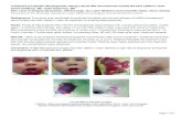 Treatment of Infantile Hemangiomas Using a Novel 650 ... Paper... · Skin Laser & Surgery Specialists, Hillsborough, NJ; Laser Medicine and Cosmetic Clinic, Kirov, Russia Presented