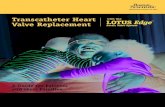 Transcatheter Heart Valve Replacement · The LOTUS . Edge. TM. Aortic Valve is a permanent implant designed to improve the aortic valve function for patients with severe calcific