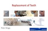 Replacement of Teeth · Restoring Missing Teeth Removable Partial Dentures (RPD) in 2017 2009 Adult Dental Survey found nearly one in five adults (20%) wore removable dentures of