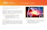 HIP LABRAL TEAR - The Physio Movement · 2017. 4. 13. · connective tissue within the hip joint. ANATOMY: The hip is a ball and socket joint that occurs between the head of the femur