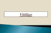 Definition acquired skin condition characterized by circumscribed … · 2019. 12. 25. · 1)Generalized vitiligo (non-segmental vitiligo ) : More common . Usually starts at the second