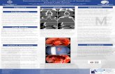 ePosters, Meeting Services, Poster Templates - Nasocutaneous … · 2016. 5. 12. · moderately displaced posterior table fractures.1 Unrecognized frontal recess injury can occur