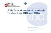 Pitfalls and anatomic variants in shoulder MRI and MRA ... · Pitfalls in shoulder MR Imaging/23.4.2016 / 2-o’clock 4-o’clock 7-o’clock 9-o’clock Posterior Anterior Normal