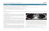 Cardiac sarcoma: A Case Report - OAText · 2019. 3. 21. · Cardiac sarcoma was defined with histopathologic examination of iliac bone biopsy. Discussion Primary cardiac sarcomas