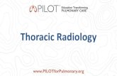Thoracic Radiology - PILOTforPULMONARY · 2019. 8. 13. · Smoking-related Respiratory bronchiolitis-ILD (RB-ILD) Respiratory bronchiolitis Desquamative interstitial pneumonia (DIP)