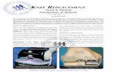 Knee Replacement - Dr Keith Holt · Compartmental Knee Replacement necessitating a revision. Male and female combined. Other designs try to replicate Anterior Cruciate Ligament function