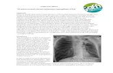 GAFFI Fact Sheet TB and its sequela chronic pulmonary … · 2019. 9. 4. · When pulmonary TB is less frequent, other pulmonary disorders are more important, notably COPD and non-tuberculous