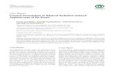 Unusual Presentation of Bilateral Radiation-Induced ...downloads.hindawi.com/journals/crionm/2020/5768438.pdf · 04.02.2020  · Umesh Jayarajah ,1 Kavinda Nagodavithane,1 Oshan Basnayake