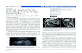 Ureteral Inguinal Hernia Presenting with Ipsilateral ...€¦ · Central rii cellece i e ccess JSM General Surgery: Cases and Images Cite this article: Morrison Z, Petronovich J,
