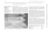 oint sepsis - ard.bmj.com · In osteoarthritis the joint space is narrowed with adjacent sclerosis and osteo-phytosis, butnoerosive change. Inhemiplegic patients unilateral sacroiliac