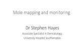 Mole mapping and monitoring Dr Stephen Hayes · Stephen Hayes’ back! •Lots of moles, several are atypical •History of blistering sunburn in youth •Family history of melanoma