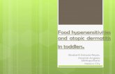 Food hypersensitivities and atopic dermatitis in toddlers. · Food allergy and atopic dermatitis The association between atopic eczema and food allergy has long been recognized as