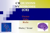 CROUZONS SYNDROME (CS)€¦ · Crouzon syndrome was first described in 1912. Crouzons is a genetic disorder characterized by the premature joining of certain bone of the skull (craniosynostosis)