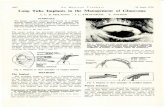 SA MEDIESE TYDSKRIF Long Tube Implants in the Management of Glaucoma · 2017. 12. 17. · 1062 SA MEDIESE TYDSKRIF 26 Junie 1976 Long Tube Implants in the Management of Glaucoma A.