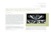 Bowell – Wall thickening Épaississement de la paroi du tube ...Cunha R. Bowel wall thickening at CT: simplifying the diagnosis. Insights Imaging 2014;5(2):195-208. Références