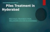 piles treatment in Hyderabad