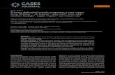 Case report Primary abdominal ectopic pregnancy: a case reportCase presentation: A 34-year-old woman, (gravida 2, para 1) suffering from lower abdominal pain and slight vaginal bleeding