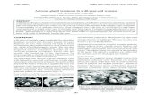Adrenal gland teratoma in a 40-year-old woman Report/vVvVkmk_shrestha.pdfMature cystic teratoma involving adrenal gland. Endocr Pathol 2002; 13: 59-64. 14. Hui JPK, Luk WH, Siu CW