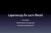 Laparoscopy for 10cm fibroid - Amazon S3...• 3/5 Peritoneal washings after resection myoma positive for myoma cells Monash protocol •If pre-menopausal •No rapid myoma growth